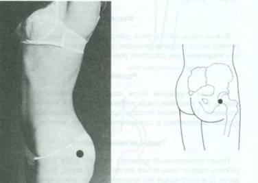 Тазобедренный сустав точки активные