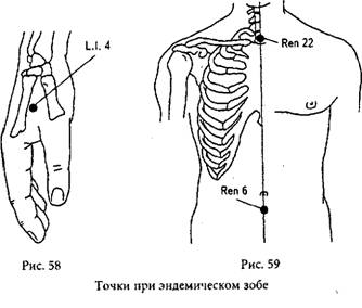 Точки рис. Щитовидная железа точки акупунктуры. Акупунктурные точки щитовидной железы. Массажные точки для щитовидной железы. Точки для массажа щитовидной железы.