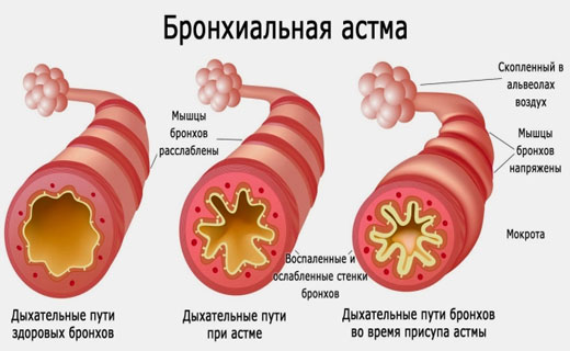 дыхательные пути